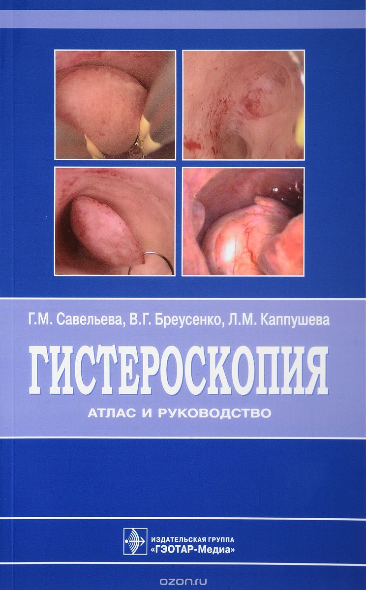 Гистероскопия. Атлас и руководство, Г. М. Савельева, В. Г. Бреусенко, Л. М. Каппушева